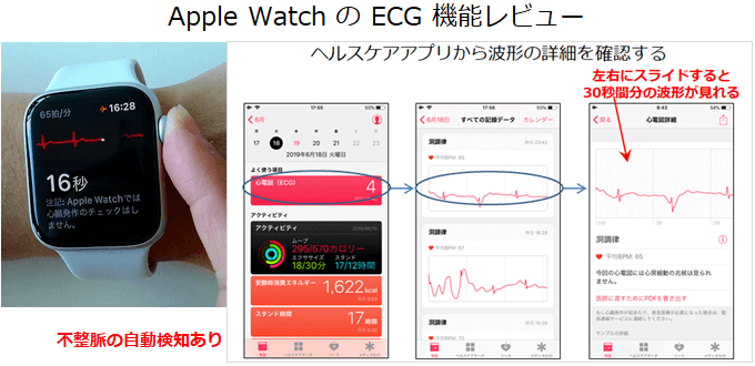 Apple Watch 心電図アプリの概要