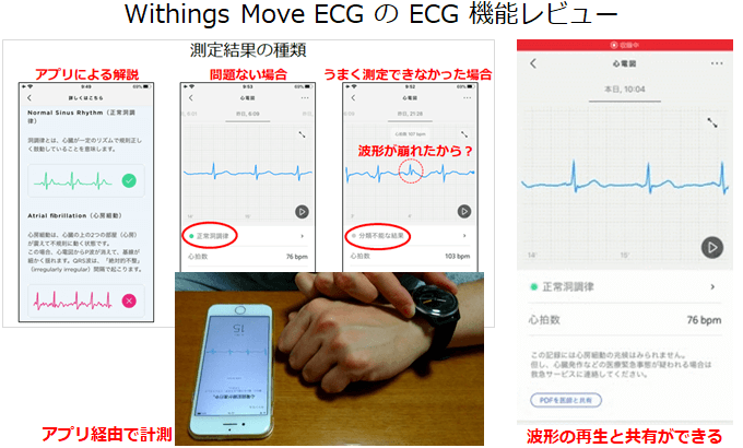 Withings Move ECG 心電図アプリの概要