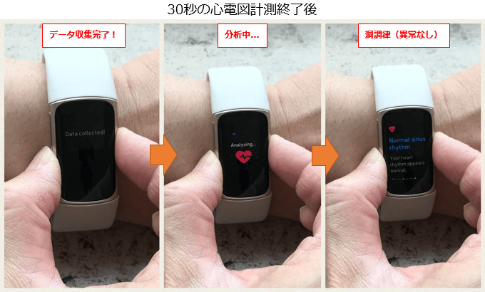 Fitbit Charge 5 ECGアプリの計測完了後